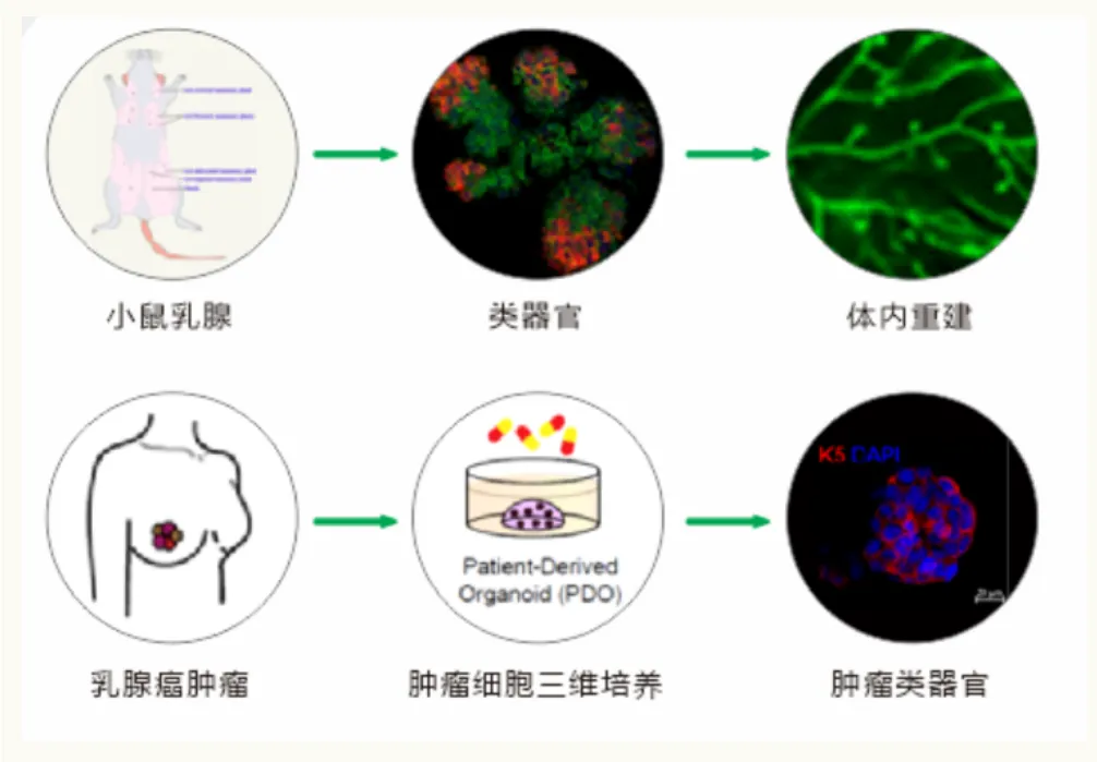 Diagram of organoid workflows: mouse mammary gland to organoid to in-vivo reconstruction, and breast tumour to patient-derived organoid