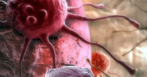 The Immunotherapy Revolution Is Under Way