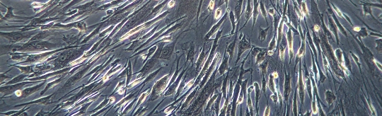 A Closer Look at Mesenchymal Stem Cells