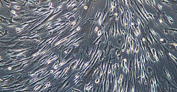 Mesenchymal Stem Cells differentiate into a variety of cell types